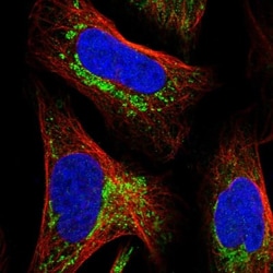 MALSU1 Antibody, Novus Biologicals 0.1mL; Unlabeled:Antibodies, Polyclonal